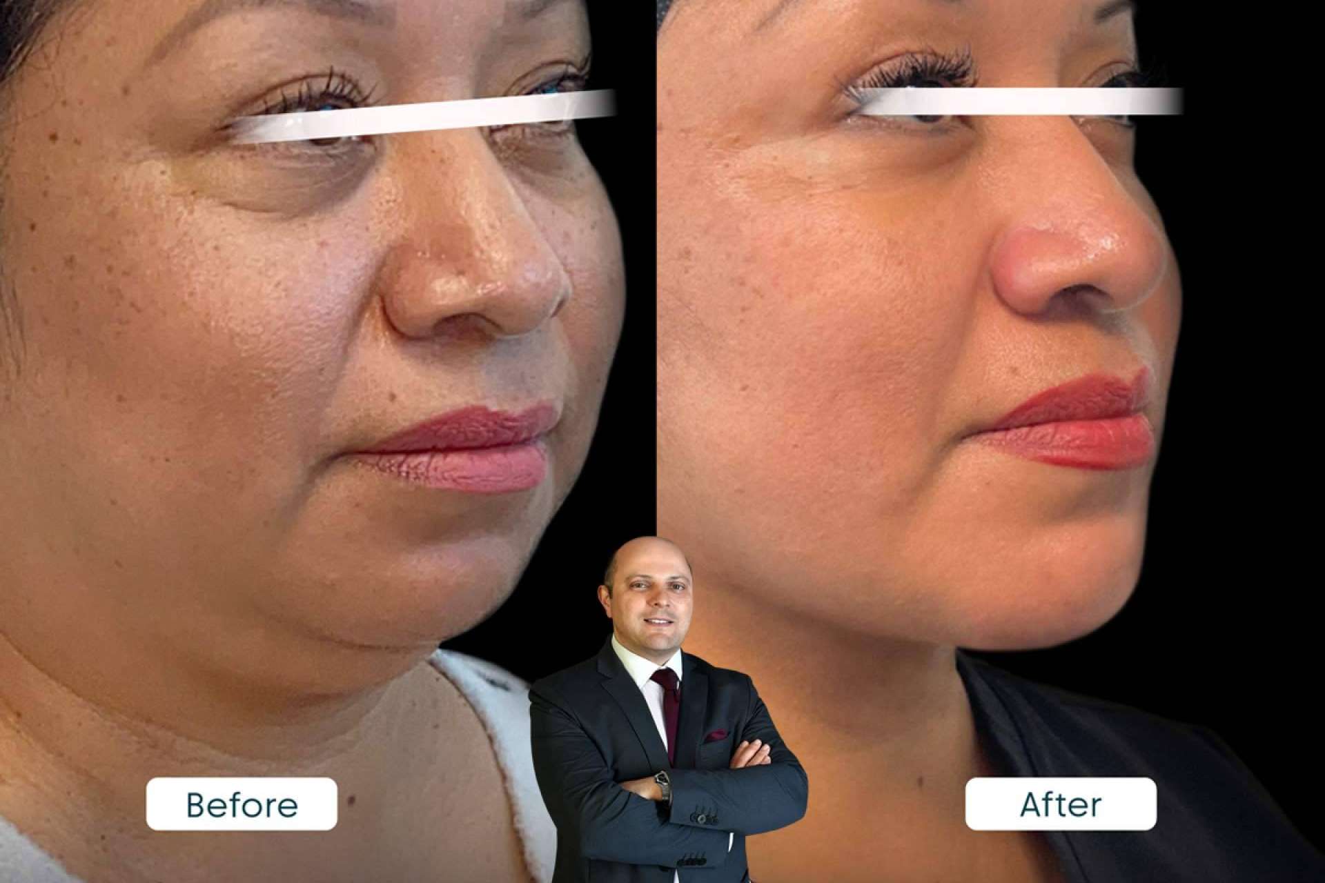 Top Celebrity Plastic Surgeon Brings Beverly Hills Beauty to Miami